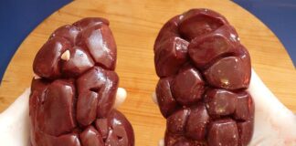 Czy nerka jest liczona jako bagaż podręczny?